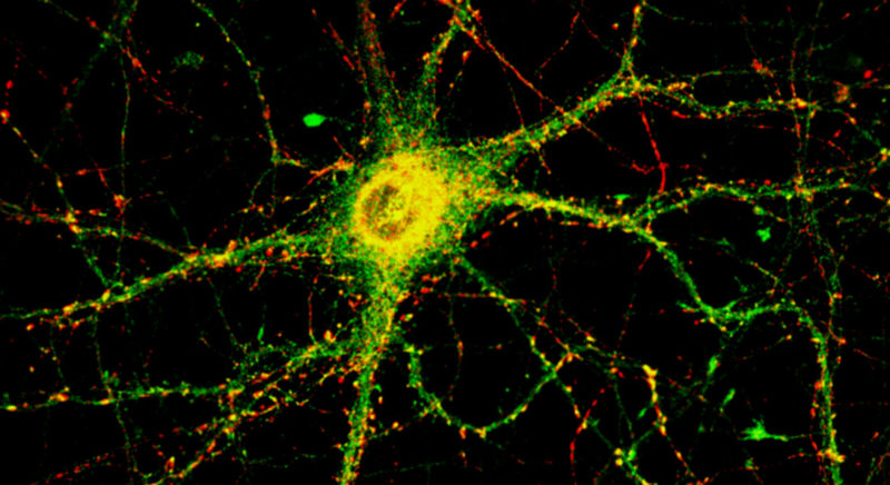 YANG LAB – We are a neuroscience research lab located in the Tufts ...
